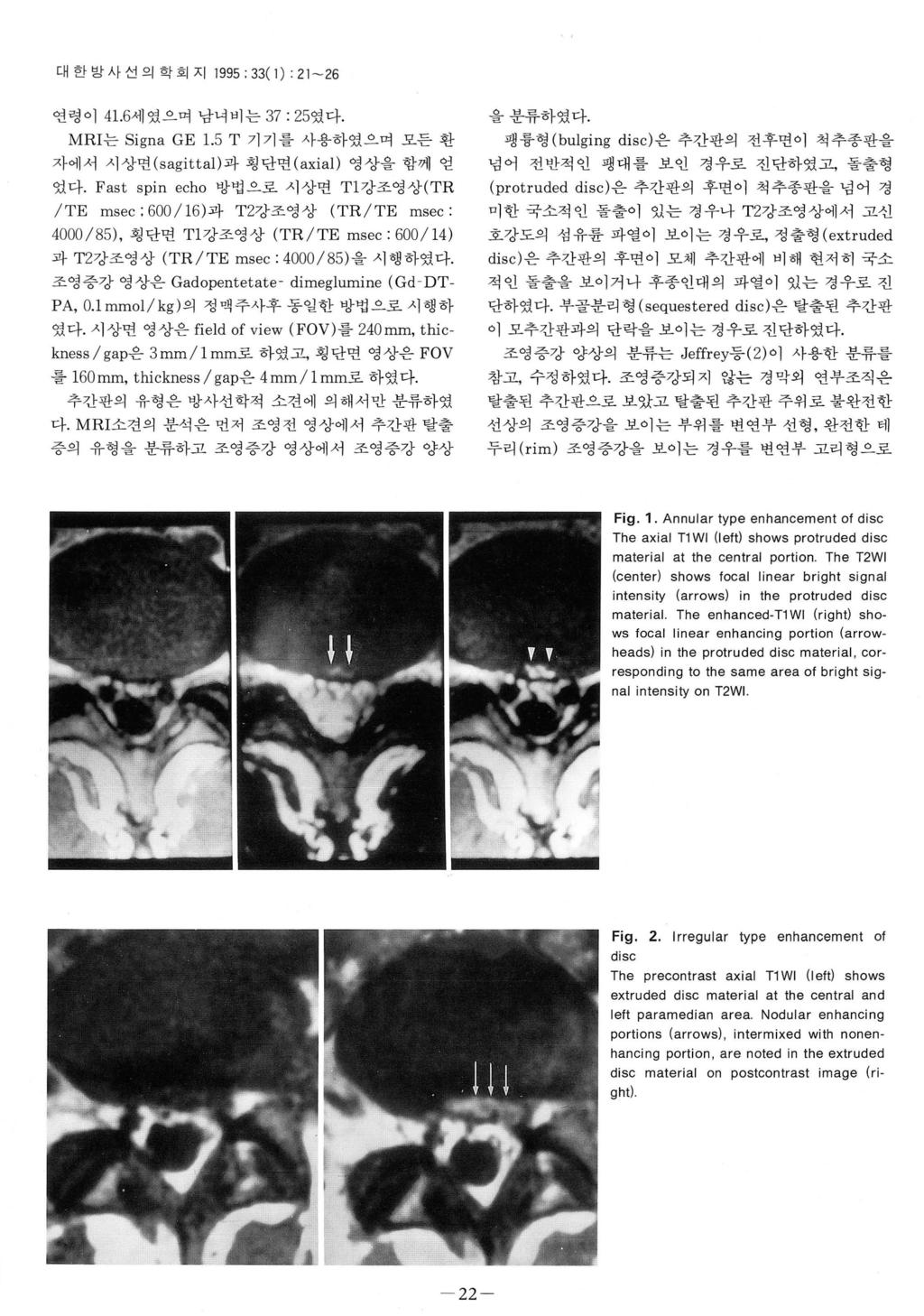 대한방사선의학회지 1995; 33( 1) : 21-26 연령이 4 1.6세였으며남녀비는 37: 25였다. MRI는 Signa GE 1.5 T 기기를사용하였으며모든환자에서시상면 (sagittal) 과횡단면 (axial) 영상을함께얻었다.