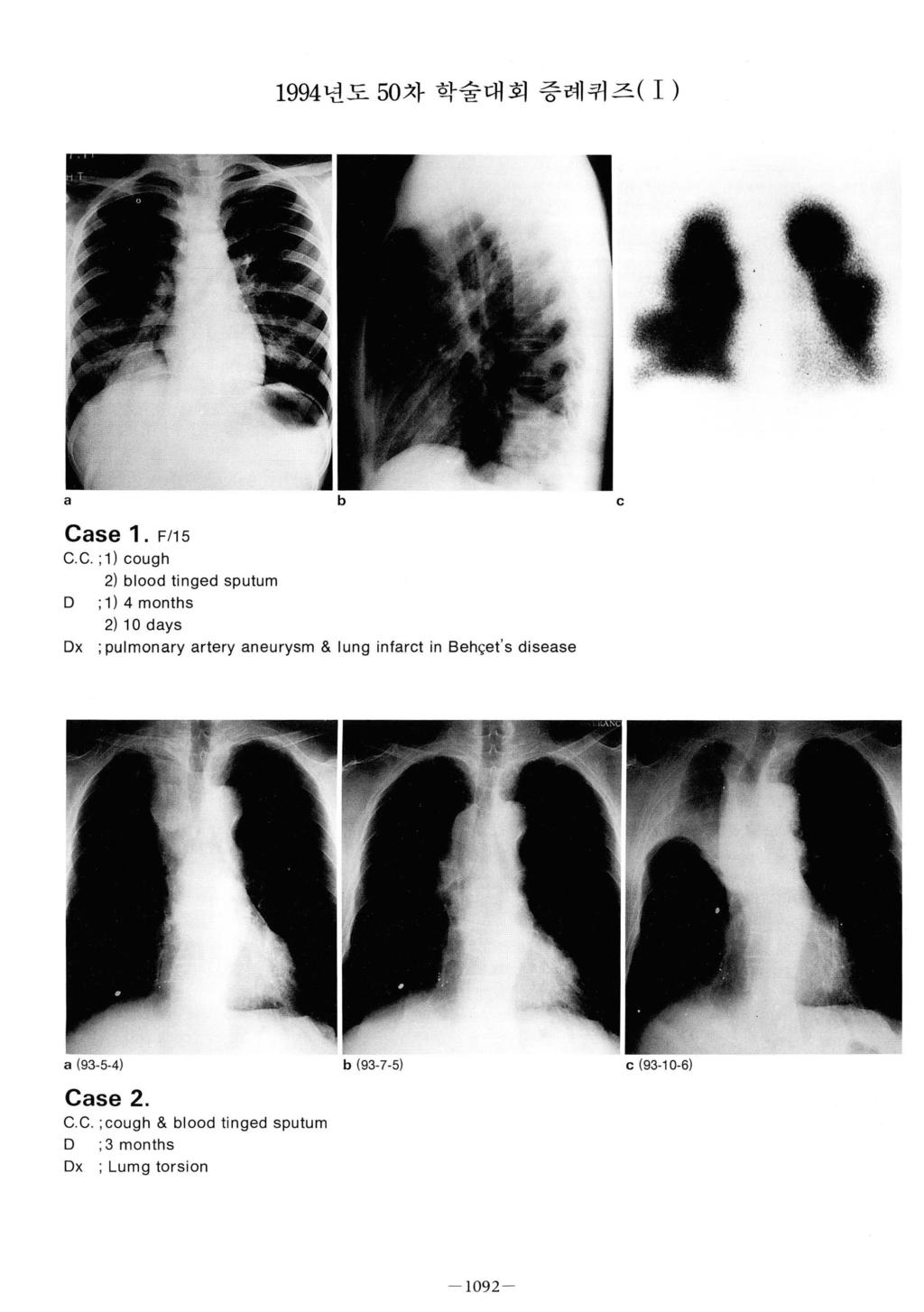 1994 년도 50. 차학술대회증례퀴즈 ( 1 ) a b c 