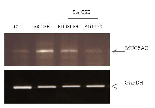 SB203580 also inhibited p38 MAPK phosphorylation as much as to the level of control and CSE treatment group (CTL: control, CSE: 5% cigarette smoke extract solution). 3.