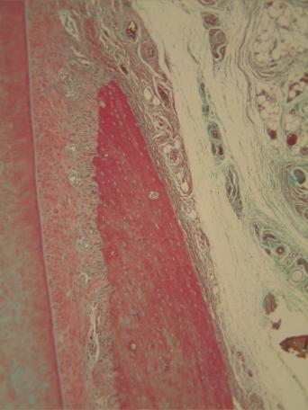 * * A B C D E F Fig 11. Masson trichrome stain.