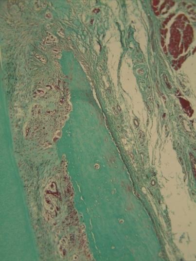 green, which showed alveolar bone was highly activated, E: Young 21