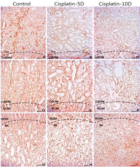 In the control group, TUNEL-positive cells were rarely expressed, whereas in the 5D group, TUNEL-positive cell was increased in all region including, Co, OM, and IM if compared to the control group.