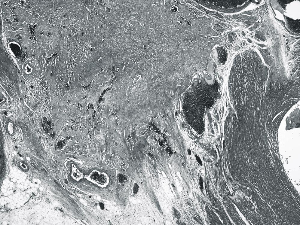 전양빈 외 기계적 경심근 혈관재형성 Fig. 6. One rat shows neovascularization. New blood vessels are scattered in the ischemic endocardium. () Masson-Trichrome stain, 40. () H&E stain, 200.