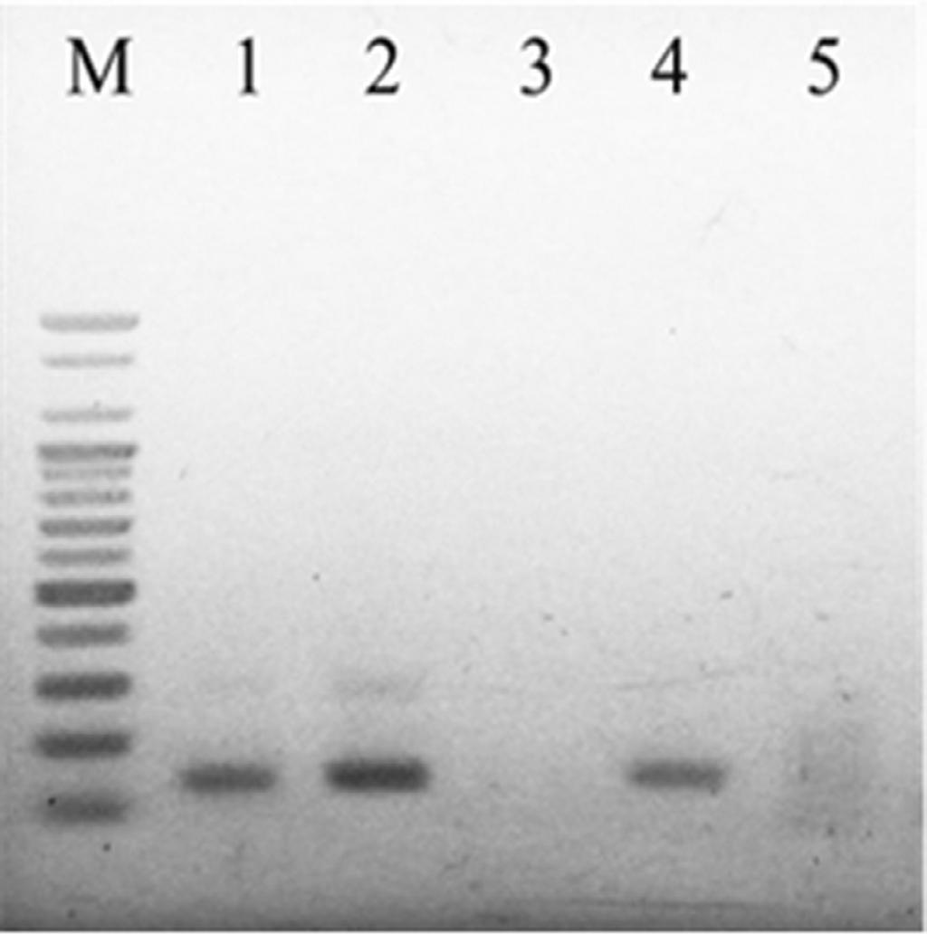 49 RPA 37 C, BQCVspecific RPA., Heat block, PCR. 40 ( ), RPA 1.5% agarose gel. 37 C, 131bp BQCV DNA, 37 C heat block PCR BQCV DNA band. RPA RPA (Fig. 10)