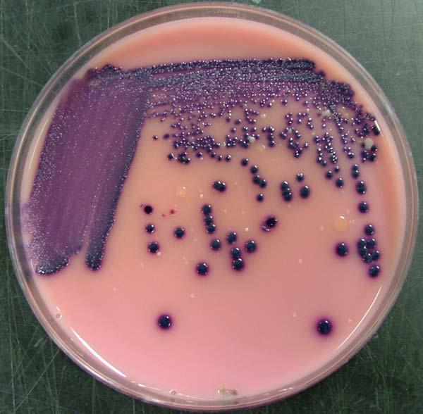 Escherichia coli CHEC Agar