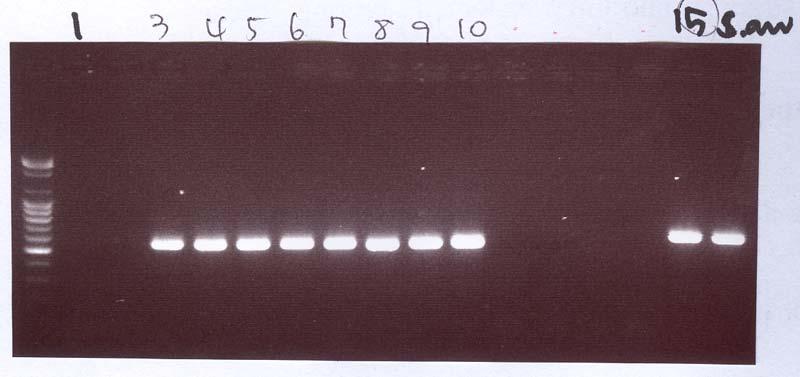 simulans Lane 13: S. auricularis Lane 14: S.