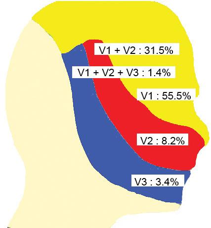 - 이현준외 : 한국인안면부대상포진임상양상 - Figure 1. Age distribution of patients. Distribution of patients with ocular involvement (n=82) and facial involvement (n=146). 가있는병변부위로정의하였다.