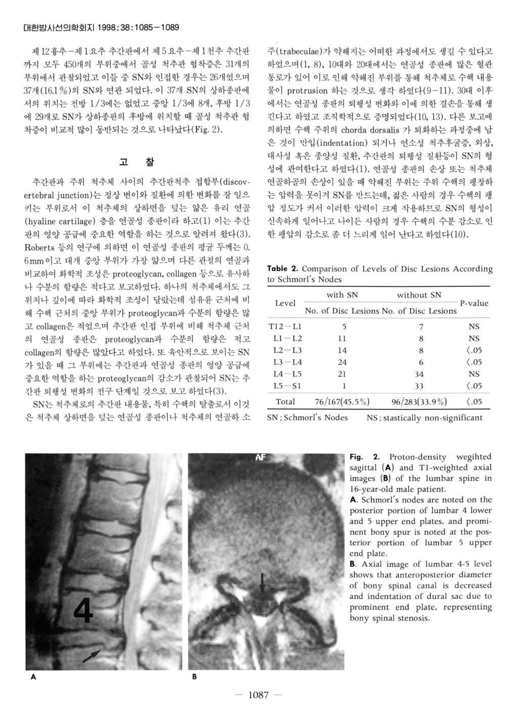 대한방사선의학회지 1998; 38 : 1085-1089 제 1 2 흉추 - 제 1 요추추간판에서제 5 요추 - 제 1 천추추간판 까지모두 450 7 ~ 의부위중에서골성척추관협착증은 3 1 개의 부위에서관찰되었고이들중 SN 와인접한경우는 26 개였으며 3 7 개 (1 6.1 % ) 의 SN 와연관되였다.