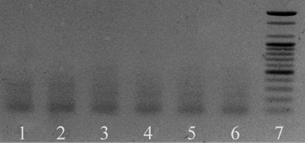 그림 3.3 Gel electrophoresis of multiplex PCR assay products for non-target strains. Lane 1, E. coli O157:H7 ATCC 43895; Lane 2, B. subtilis KCCM 11316; Lane 3, L.