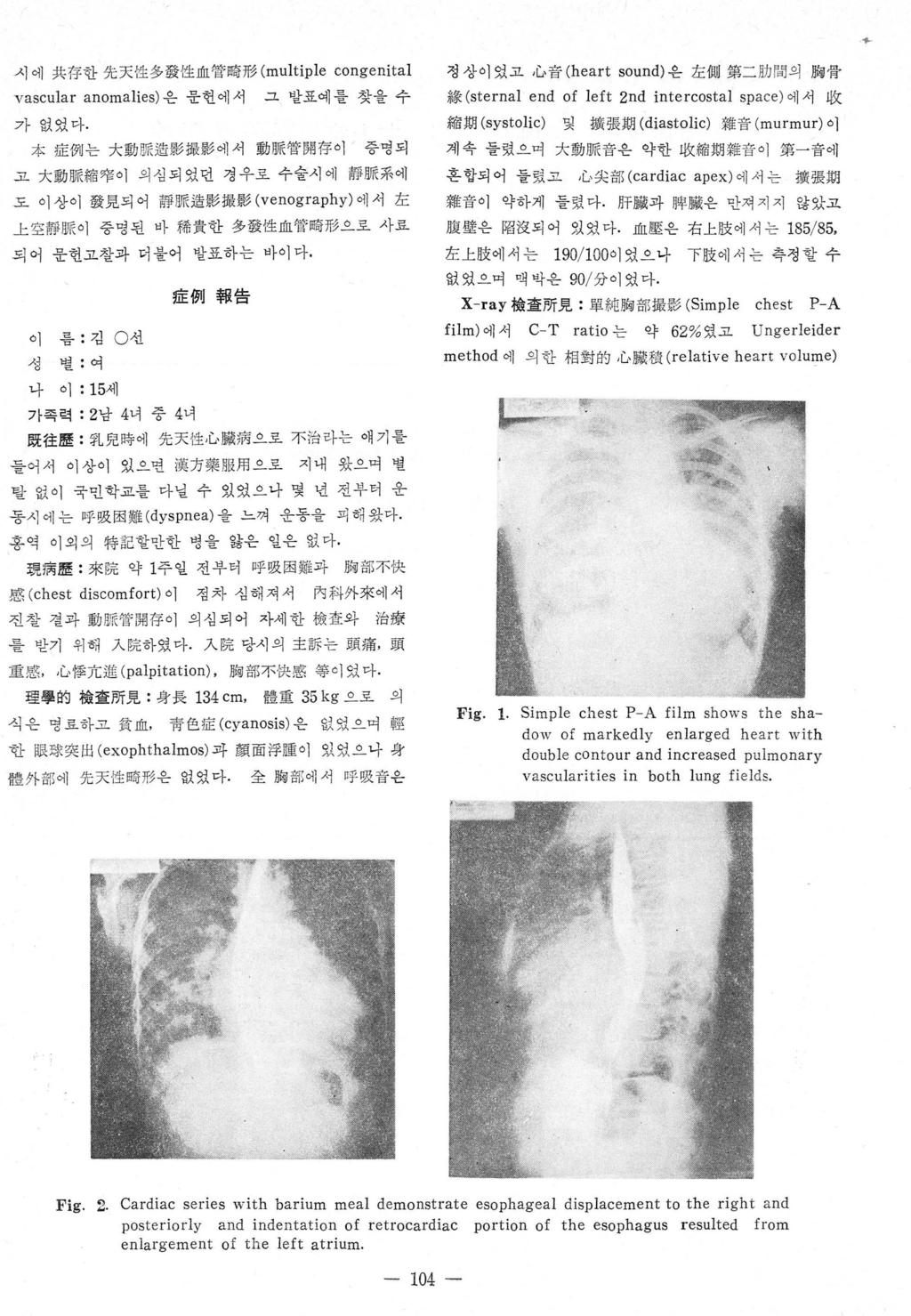 ~ 시에共存한先天 { 生多發性血管略形 (multip l e congenital 정상이었고心音 (heart sound) 은左때第二助間의뼈骨 vascular anomalies) 은운헌에서 그발표예를찾을수 隊 (sterna l end of left 2nd intercostal spa ce) 에서 收 가없었다.