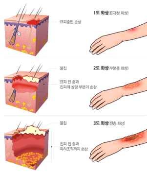 가. 일반적인소화기를사용하거나물을분무한다. 나. 화재원인물질의누출을먼저중지시키고진화를시도한다. 화재원인물질의누출을즉시중단시킬수없는경우소방서에연락하고, 위험하지않다고판단되면화재원인물질을실외로신속히이동시켜야한다. 다. 화재진압은바람을등지고시도한다. 라. 가능한한먼거리에서화재를진압한다. 마.