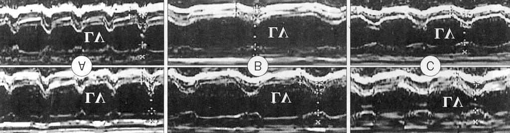 세포자멸의확인 - Fig. 2. M mode echocardiographic images of left ventricle in mice treated with saline A, ADR alone B, IGF-1 and ADR C.