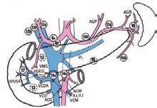 Lymph node station 10 Splenic hilar LN and proximal to 1 st lt gastroepiploic artery 11p Proximal splenic artery 11d Distal splenic artery 12a Hepatoduodenal ligament LNs along the