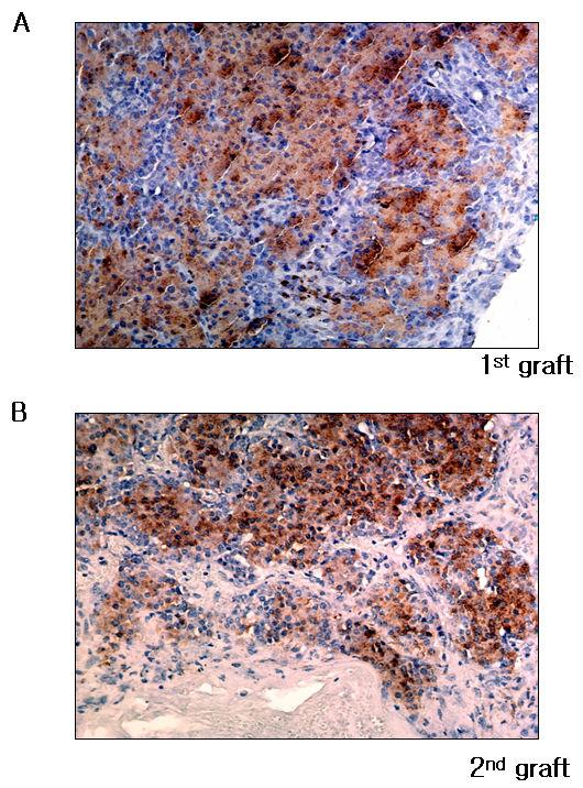 - 당뇨병제 30 권제 1 호, 2006 - Fig 5. Insulin immunohistochemical staining in islet graft. (A) Islet of bone marrow cell donor in the graft was stained with insulin immunohistochemical staining at 56th day.