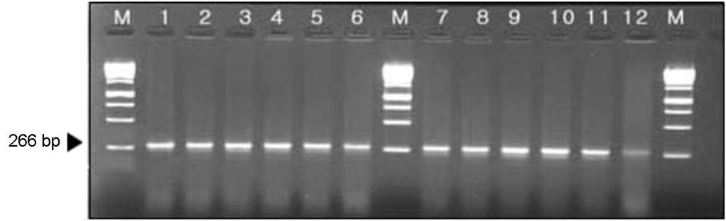 CJ-9; lane 10, strain no. CJ-10; lane 11, strain no. CJ-11; lane 12, strain no. CJ-12. Fig. 2. Agarose gel electrophoresis of PCR generated by using primer pairs for glya gene for identification of C.