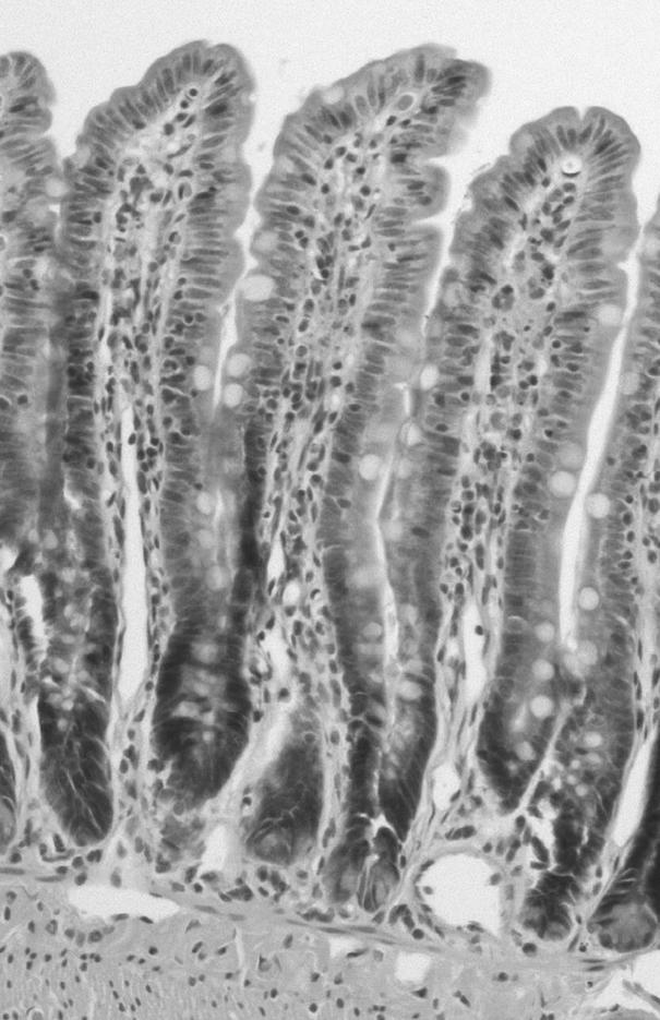 4 대한혈관외과학회지 : 제 24 권 제 1 호 2008 Fig. 3. Microscopic finding of the bowel mucosa of rats after 30 minute ischemia and 6 hour reperfusion injury.