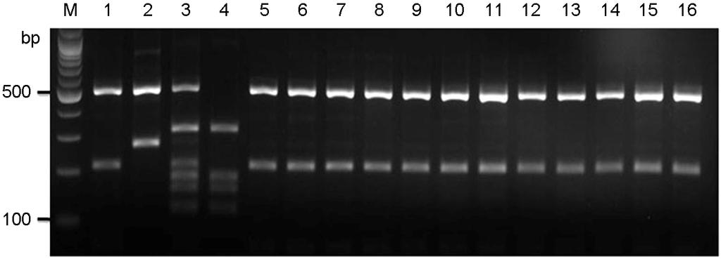 M, molecular marker (100 bp DNA ladder). Figure 2. URA5-RFLP profiles identified after double digestion with the restriction enzymes HhaI and Sau 96I. Lane #1~#4, C.