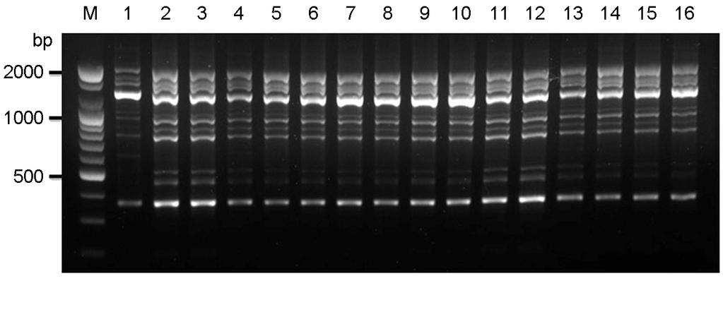 116 SH Park, et al. RAPD 분석 Random primer 2종류, OPH-02와 OPH-12를이용하여 RAPD 분석결과는 Fig. 3과같다. Primer OPH-02를이용한 RAPD profile을분석결과 (Fig. 3A), 임상균주간의동일한패턴으로각균주의차이가없었으며, primer OPH- 12를이용한결과에서도 (Fig.