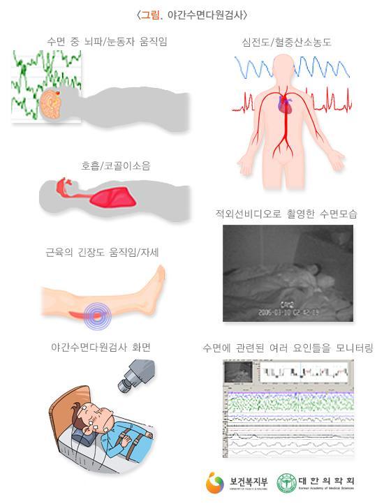 야간수면다원검사