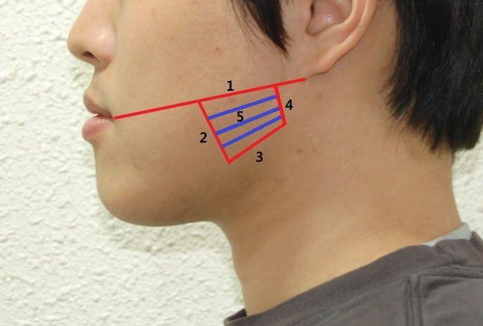 FIGURES Fig. 1 안전영역 1.