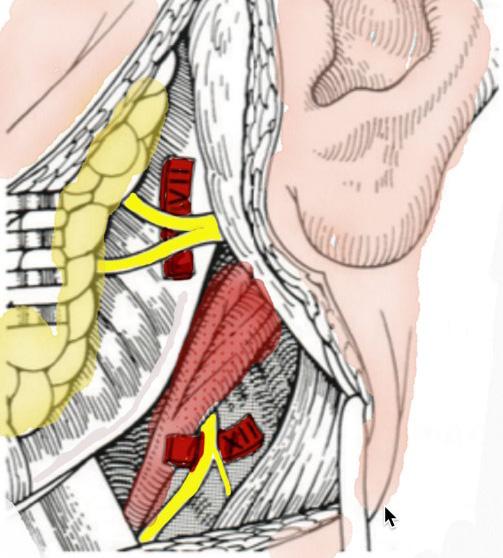 그역할이유사하며약 4-6개의신경다발로구성되어있다. 안면신경의측두골에서나와두꺼운신경외막을형성하는부분과매우유사하며이하선으로들어가기직전의안면신경의단면적보다약 2 mm정도크기때문에신경치환술로사용하기에는매우좋은조건을가지고있다 (Fig. 1)