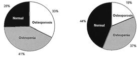 - 김해림외 4 인 : 강직성척추염에서골다공증과 srankl/opg 의불균형 - Table 1. Clinical characteristics of sixty patients with ankylosing spondylitis Age (mean±sem, year) 32.1±1.