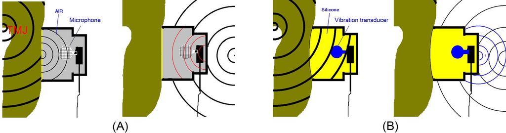 Se-Jin Joo et al. Fig. 1. Sensor design (A) Sonography Sensor Design.