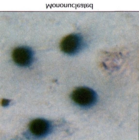 2) 레트로바이러스에 의하여 nls-lacz 유전자가 심 개 이상인 다핵세포도 관찰되었으나 이들 다핵세포는 근세포에 전달되어 X-gal 염색된 세포의 핵의 형태는 1% 미만이었다(Fig. 3).