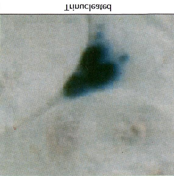 3) Thymidine 표지 유무와 X-gal염색 유무에 따라 세포들을 4군으로 분류할 수 있는데 단핵심근세포, 다핵 심근세포 모두에서 이들 4군의 세포, 즉 thymidine 양성 이면서 X-gal 염색 양성인 세포와, thymidine 음성이 지만 X-gal 염색 양성인 세포, thymidine 양성이면서도 X-gal 염색 음성인 세포,