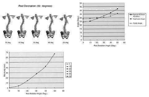 decrease of Cobb angle, and a slight increase of AVAR during translation Fig 7 A Rotation of 3-D FEM of scoliosis The assumptions in simulation of rod rotation are, there was no change of scoliosis