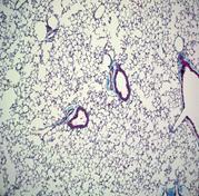 Soluble Collagen (ng/mg) In vivo