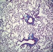 lung-fibrosis model (A) 0 WT