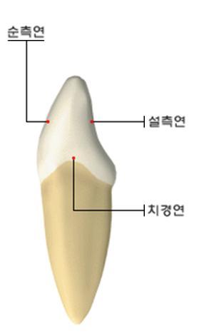 3) 근심면 : 치경연이저변이고순측연과설측연이만나는절단을정점으로하는삼각형형태 1 순측연은치경