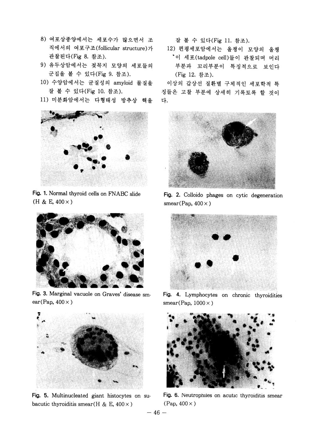 여포상종양에서는 세포수가 많으면서 8) 직 에 서 의 여 포구조 (follicular 관찰된다 (Fig