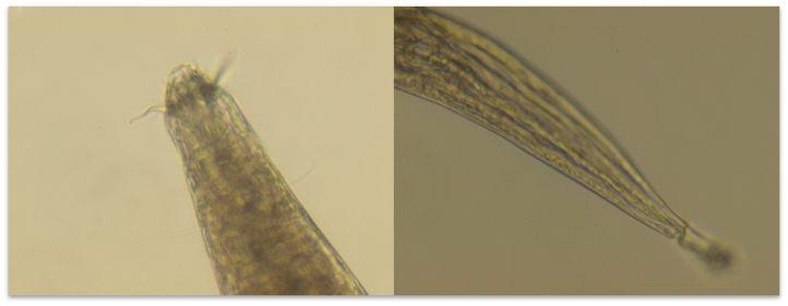 Fig. 3-25. Pictures of Nematodes(Heasasp.1,Headasp.2) Fig. 3-26.