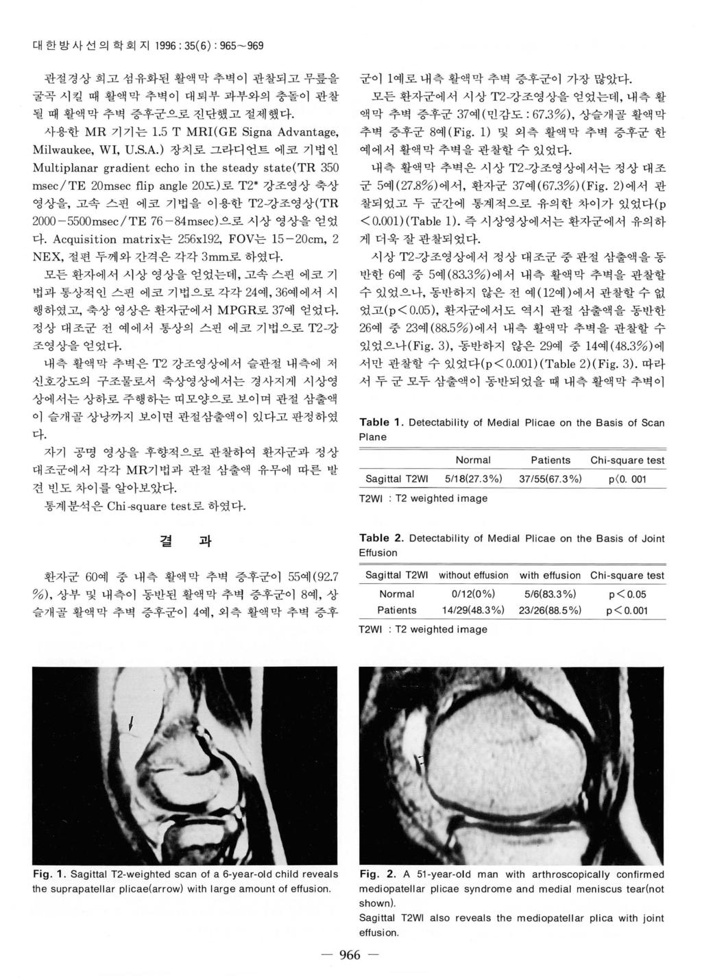 대한방사선의학회지 1996: 35(6) : 965-969 관절경상희고섬유화된활액막추벽이관찰되고무릎을굴곡시킬때활액막추벽이대퇴부과부와의충돌이관찰될때활액막추벽증후군으로진단했고절제했다. 사용한 MR 기기는 1.5 T MRI(GE Signa Ad