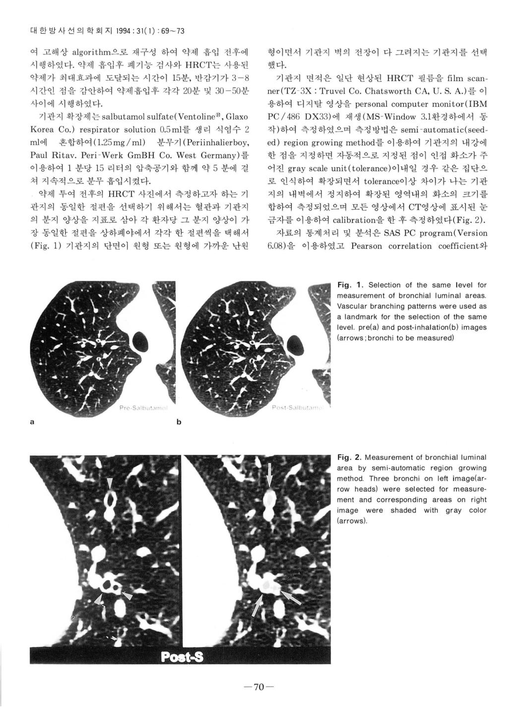 대한밤사선의학회지 1994 : 31 ( 1) : 69-73 여고해상 a l gorit hm으로재구성하여약세홉업전후에시행하였다. 약제흡입후폐기능검사와 HRCT는사용된약제가최대효과에도달되는시간이 15분, 반감기가 3-8 시간인점을감안하여약제흡입후각각 20분및 30-50분사이에시행하였다.