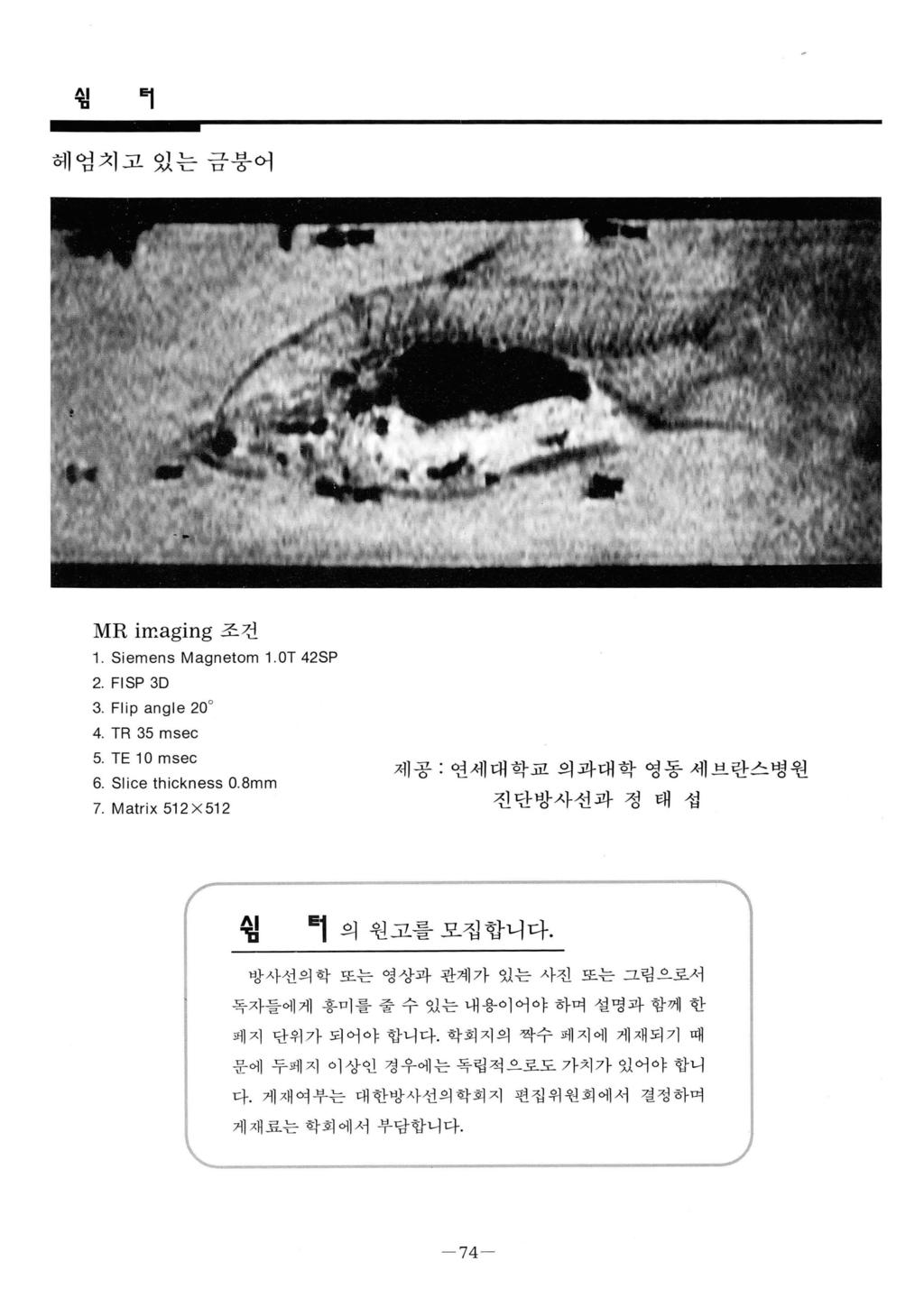 필 턱 헤엄치고있는금붕어 MR irr.aging 조건 1. Siemens Magnetom 1.0T 42SP 2. FISP 3D 3. Flip angle 20 4. TR 35 msec 5. TE 10 msec 6. Slice thickness 0.8mm 7.