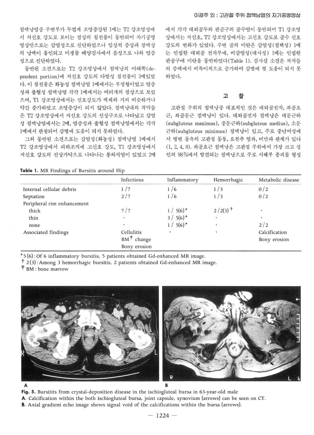 이경주오 1: 고관절주위점액닝염의자기공명영상 점액낭염중주변부가두껍게조영증강된 1 예는 T2 강조영상에 서저신호강도로보이는점상의침전물이동반되어자기공명 영상만으로는감염성으로진단하였으나임상적증상과장액상 의냥액이흡인되고미생물배양검사에서음성으로나와염증 성으로진단하였다.