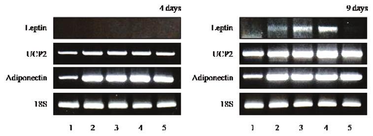 1: undifferented cells, 2: Control was treated with MDI to induce differentiation, 3, 4, and 5: MDI and 1%, 2%, and 3% of GL were treated Figure 4.