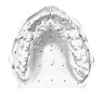 Fig. 6. The mean image on dental and edentulous cast of maxilla. Fig. 7. The overlapping image of the mean form on dental and edentulous cast of maxilla.