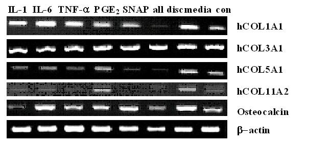 A. B. Figure 3. Effect of cytokines on the expression of hcol1a1, hcol3a1, hcol5a1, hcol11a1, and osteocalcin mrna in hlf cells. A.