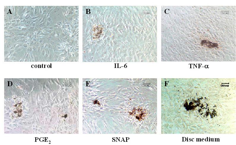 Von Kossa staining Figure 4.