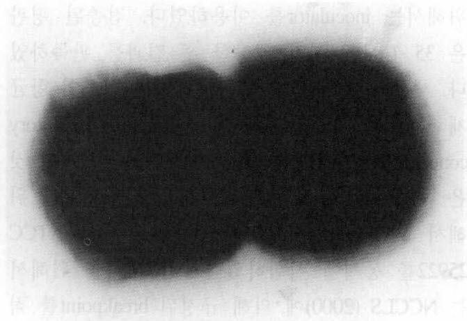 gel로전기영동하여그분획을 ethidium bromide 로염색후 554 bp로증폭된 meca 유전자띠는 자외선하에서관찰하였다.