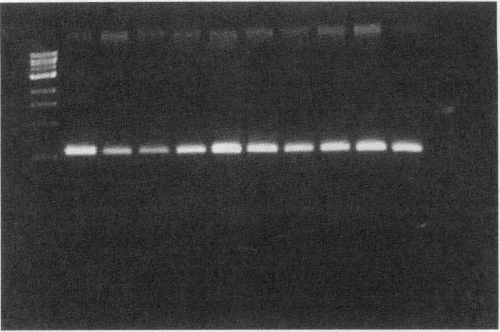M 2 3 4 5 6 7 8 9 10 11 554 bp ~ Fig. 2. Agarose gel electrophoresis of the PCR products against S. aureus isolated from ICU patients.