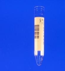 Urine Tube - Random urine sample *