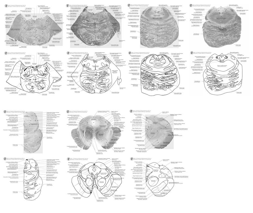 사람신경조직디지털슬라이드및뇌지도제작 183 Lower pons level Middle pons level Upper pons level Isthmus pons Inferior colliculus level Superior colliculus level Posterior commissure level Fig. 5.