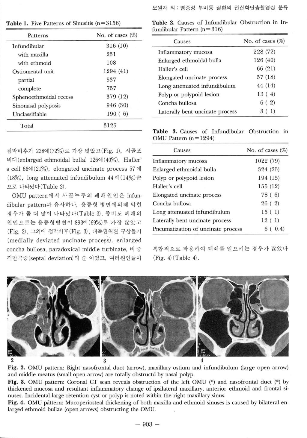 오원자외 ; 염증성부비동질환의전산화단층촬영상분류 Table 1. Five Patterns of Sinusitis (n = 3156) Patterns No.