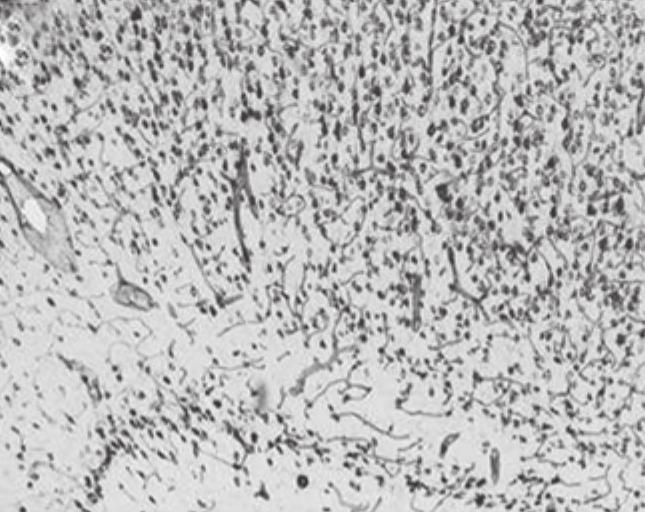 in the motor cortex was measured by Nissl staining.