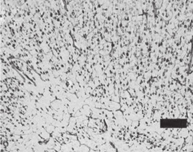 7% NeuN-positive cells (%of Normal) Infarction volume (%) 60 a b c d A 120 100 * 80 # 60 40 20 0 Normal